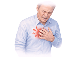 심장마비